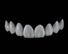 Veneers